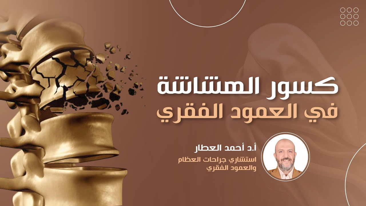 كسور الهشاشة في العمود الفقري التشخيص والعلاج بكل التفاصيل للدكتور احمد العطار