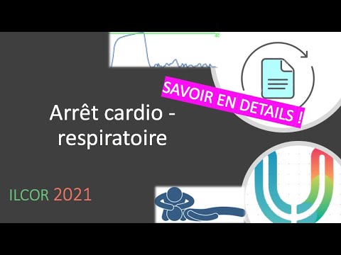 Recommandation - ECN RFE - ILCOR Arrêt cardiaque - ACR 2021