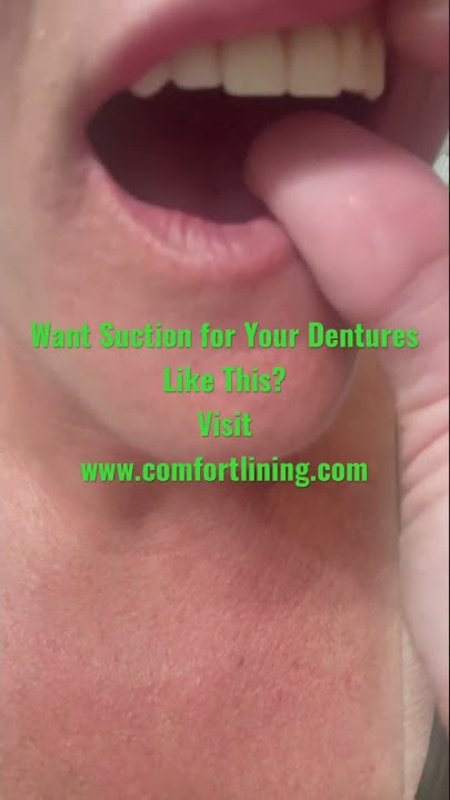 Comfort Lining-Thermoplastic Denture Adhesive 