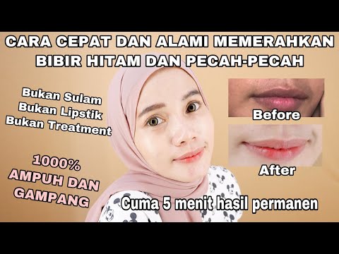 REVIEW SKINCARE RUTIN || Anisa Danisa. 