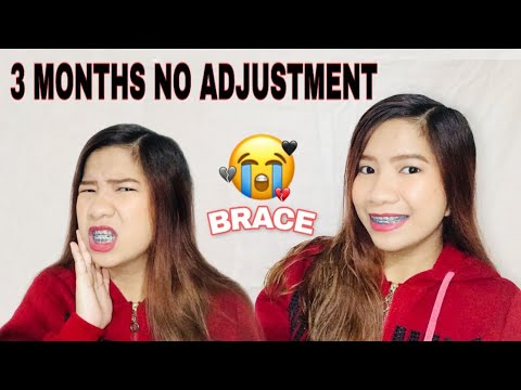 ANONG MANGYAYARI KAPAG DI NAGPA- ADJUST NG BRACES [ecq feels] +TIPS