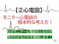 ②心電図～モニター心電図の根本的な考え方(何故、何がわかるのか循環器医が解説します)