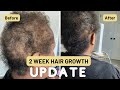 TWO WEEK HAIR GROWTH UPDATE....I&#39;M FINALLY GETTING SOMEWHERE