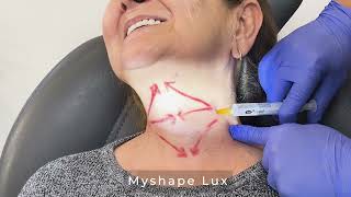 Myshape Lux Ile Boyun Uygulaması