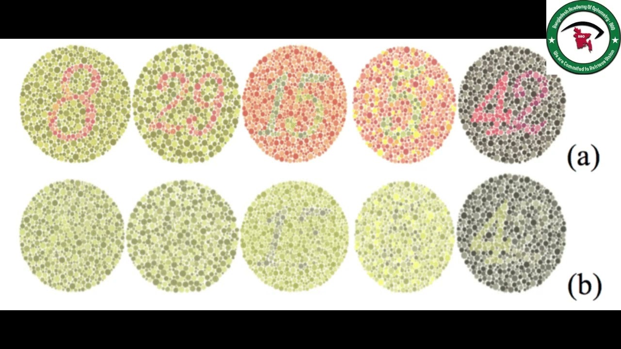 The Ishihara Colour Vision Test