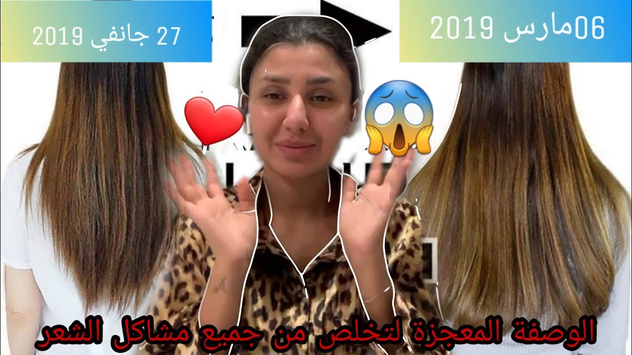 فراغات الشعر| تساقط الشعر| تطويل الشعر| تكثيف الشعر| حل لجميع مشاكل الشعر بوصفة  رائع و فعالة100%