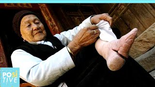 Lotus Feet The Ancient Chinese Tradition That Made Women Suffer