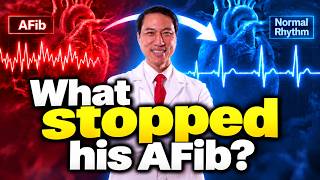 Two Failed AFib Ablations Made Him Worse—What Finally Worked
