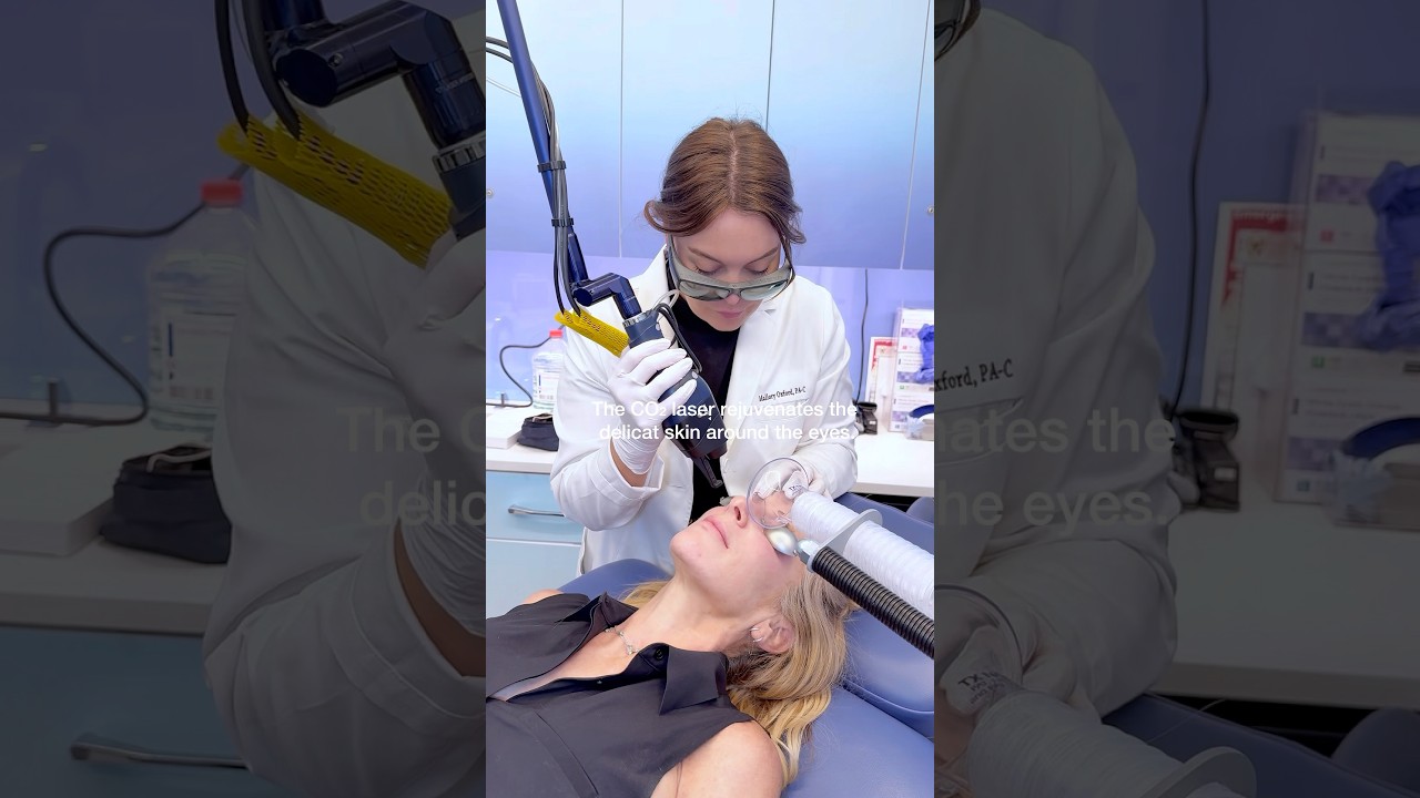 The CO₂ laser rejuvenates the delicate skin around the eyes.