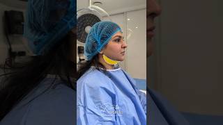 Defined jawline, refined profile - with submental liposuction