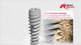 Nobel Active Nobel Biocare Implante Dental