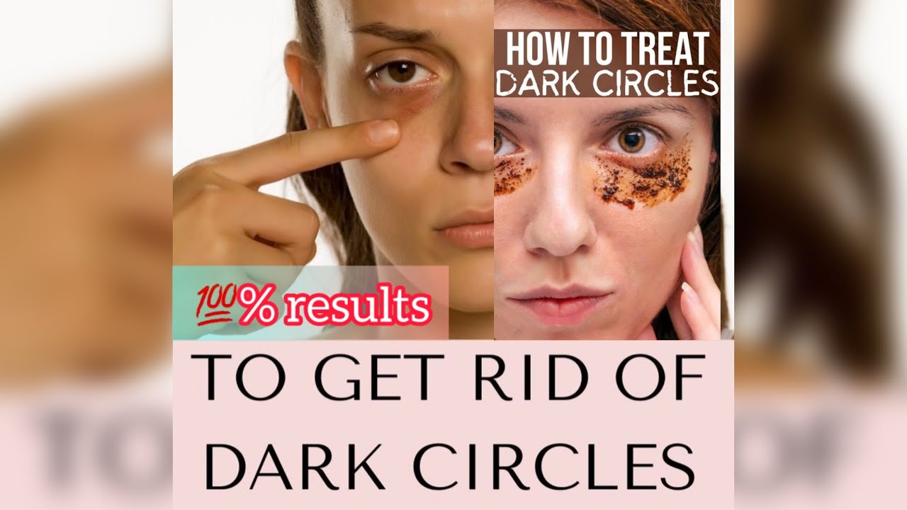 How to remove under eyes wrinkles dark circles ||Diy Home Remedies||Get ...