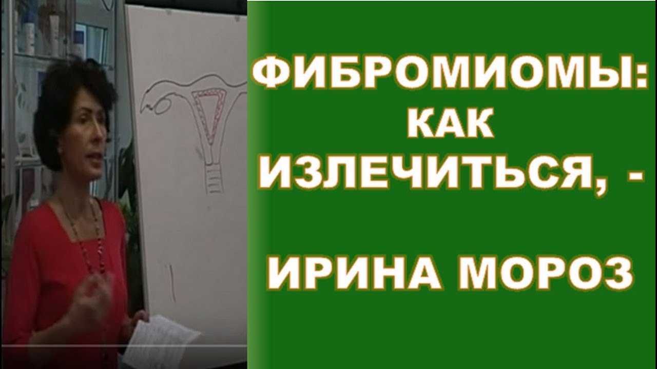 Фибромиомы. Эндометриоз. Как излечиться, - гинеколог-эндокринолог Ирина ...
