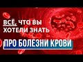 Гематологя – Кто болеет раком кожи? / Диагностика онкологии / Как предупредить болезни крови?