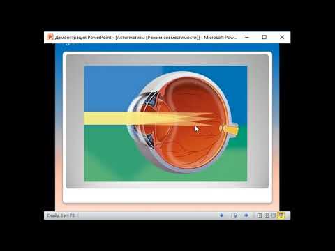 Тест на астигматизм.  Избавление от астигматизма