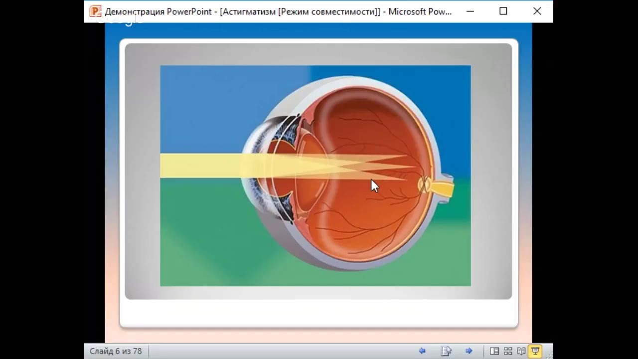 Тест на астигматизм. Избавление от астигматизма - YouTube
