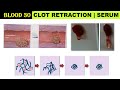 Blood 30 | Blood clot retraction | Oozing of Serum | Thrombosthenin | Blood clotting