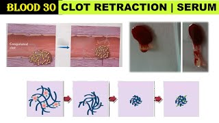 Blood 30 | Blood clot retraction | Oozing of Serum | Thrombosthenin | Blood clotting