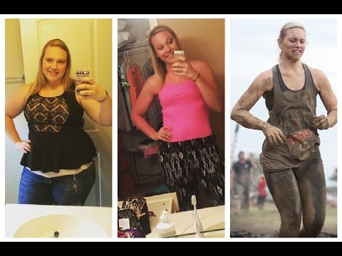 Weight Loss Surgery is a Jump Start to Healthier Living - YouTube
