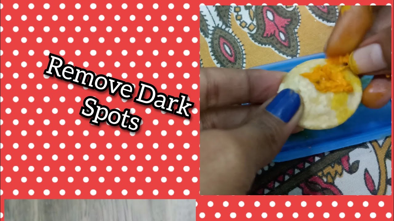 How to Remove Dark Spots ,Pimples Marks,Face Marks and Acne?