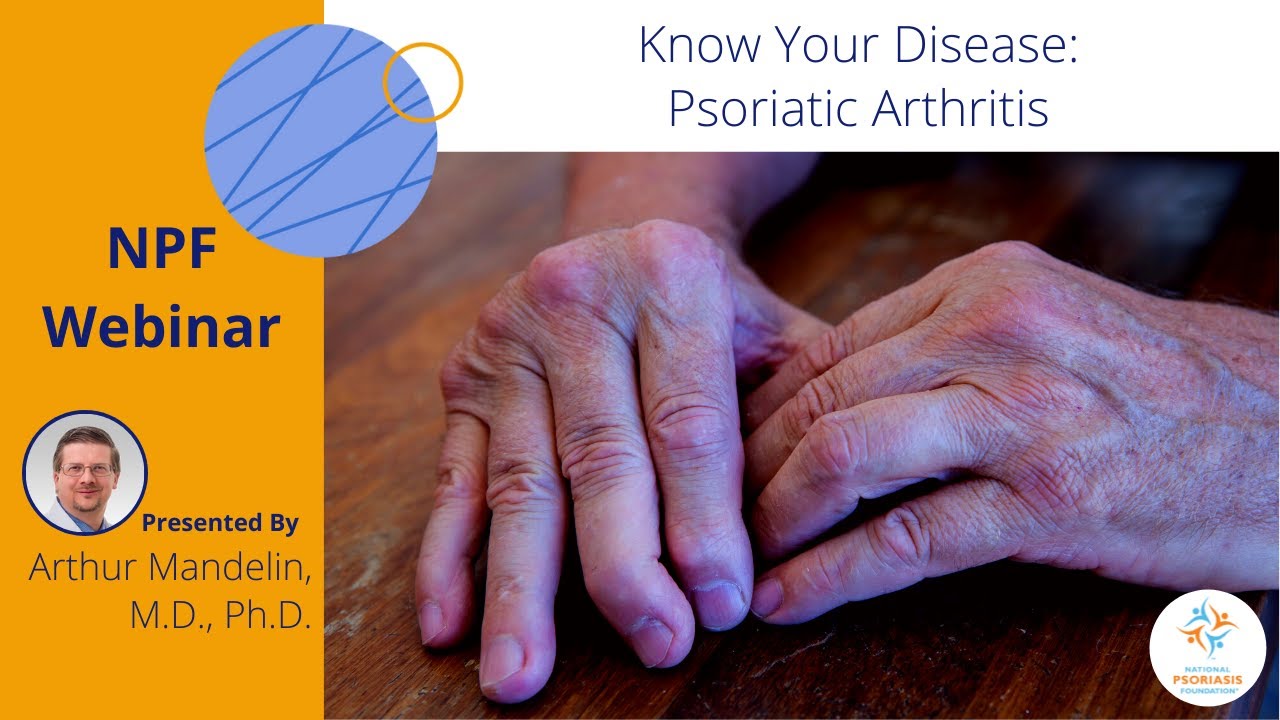 Know Your Disease Psoriatic Arthritis YouTube