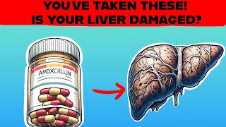 BEWARE! These 15 Medications Destroy Your Liver
