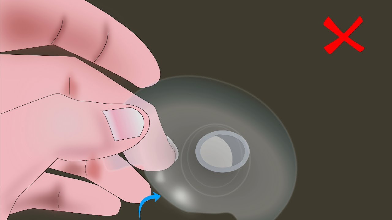 Complication  of Using Nipple Shields- English