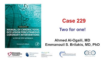Case 229: Manual of CTO PCI - Two for one