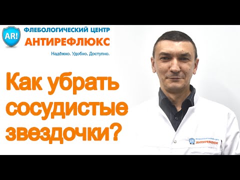 Как убрать сосудистые звездочки? Склеротерапия.