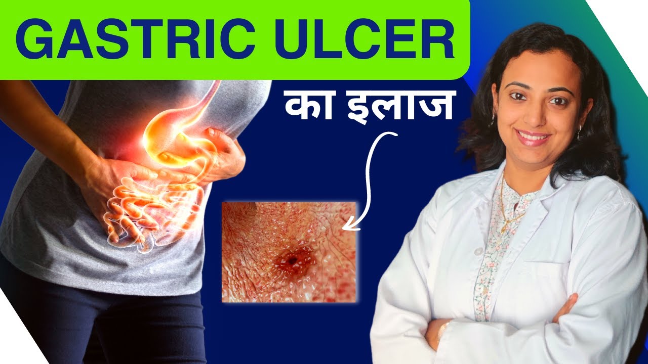 gastric-ulcer-treatment-peptic-ulcer-kya-hota-hai-kaise-thik-kare