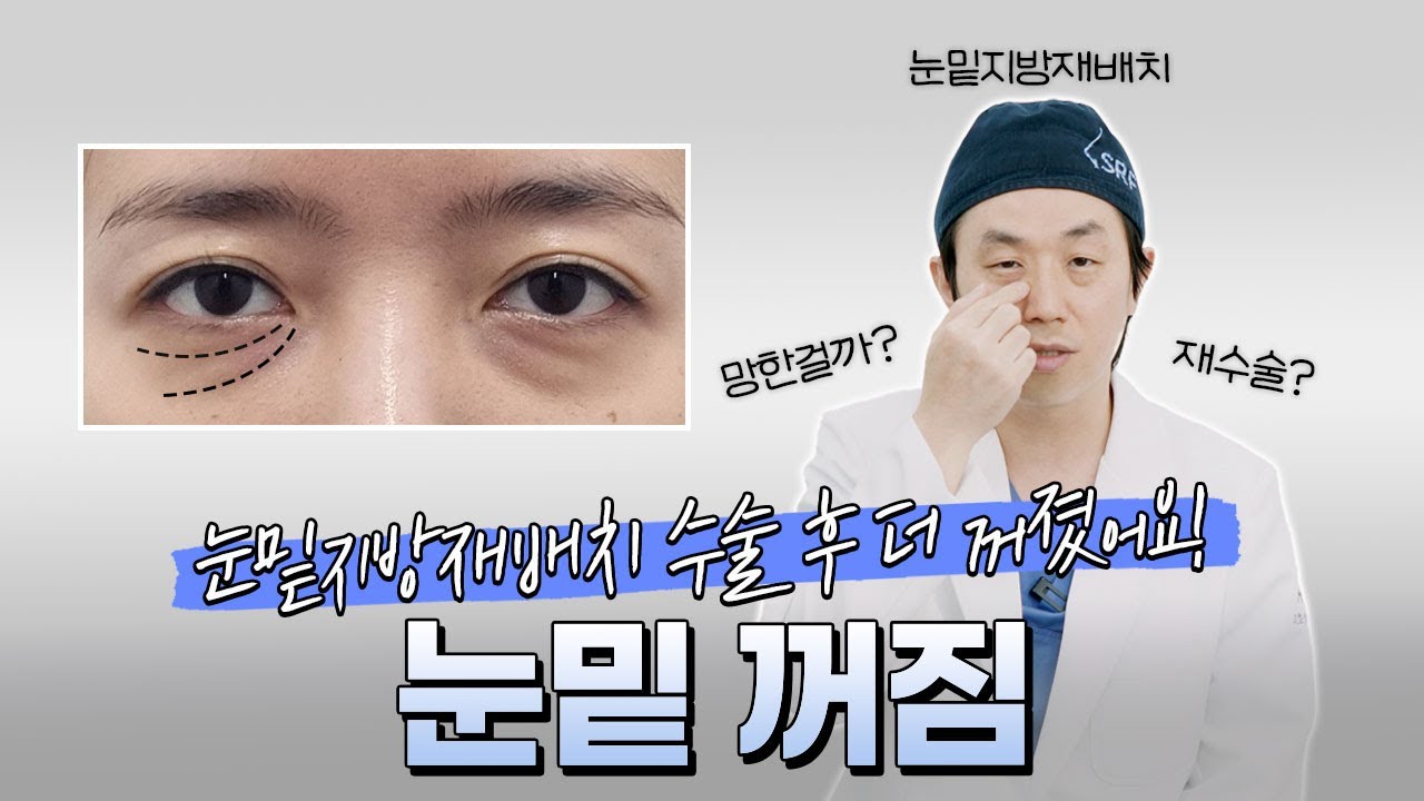 👁‍🗨 눈밑지방재배치 망한 걸까요? 💢수술 했는데 눈 밑이 더 꺼져 보이는 이유!?😥