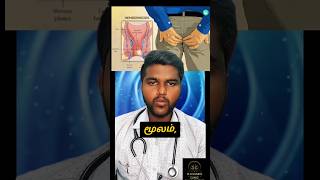 மூலம் பிரச்சனை அதனை தீர்க்கும் வழி Hemorroids problem and prevention tips#piles #pilestreatment