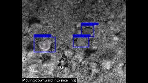 Real-time Neuron Detection in Brain Slice