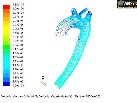 FSI simulation of