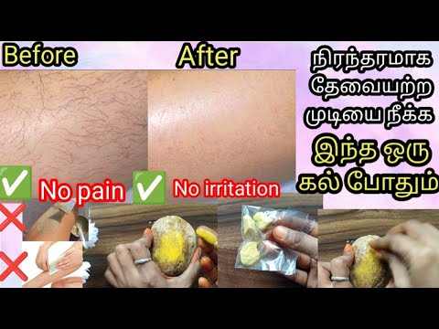 🔥ANCIENT METHOD 😱 PERMANENT SOLUTION ✅FOR UNWANTED BODY HAIR |❌NO PAIN ❌NO IRRITATION 💯👍