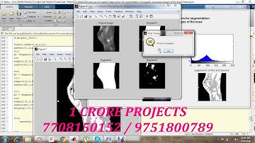 On the Use of Coupled Shape Priors for Segmentation of Magnetic Resonance Images of the Knee