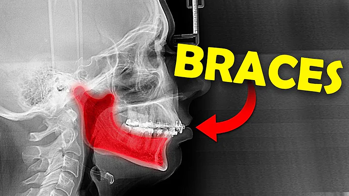 Alleviating TMJ Pain and Discomfort: Orthodontic Solutions