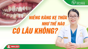 Niềng răng kẹ thừa như thế nào, có lâu không? Bác sĩ giải đáp