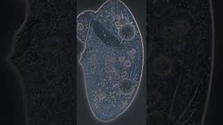 Как выглядит смерть на клеточном уровне 🔬 #microworld #biology