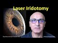 Laser Iridotomy the works,  Mahesh Ramchandani explores all about laser for angle closure glaucoma