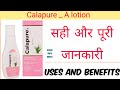 Calapure A lotion uses in Hindi || लोशन एक फ़ायदे अनेक