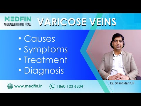 Video: Varicose Veins - Symptoms, Causes, Treatment