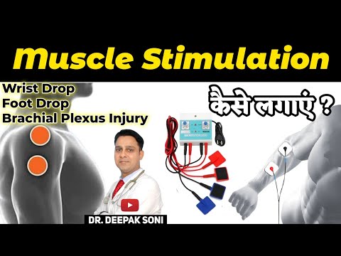 What is Muscle Stimulator Therapy in Hindi | How to Use Muscle Stimulator machine | Physiotherapy