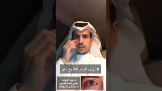 التهاب الرمد الفيروسي