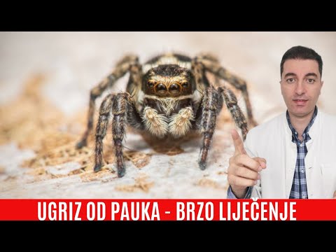 Video: Svrbe li ugrize pauka?