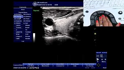 NextGen LOGIQ e: Annotation