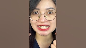 Cách đeo và tháo khay niềng trong suốt invisalign? #nhakhoathuyanh #shorts
