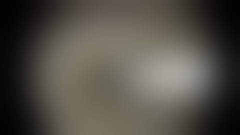 Microfracture Procedure for Knee Cartilage Injury