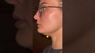 How I FINALLY transformed my side profile 🤫 #glowup #glowuptips #glowupjourney #skincare #beauty