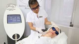 Fotoodmładzanie - zabieg laserem IPL